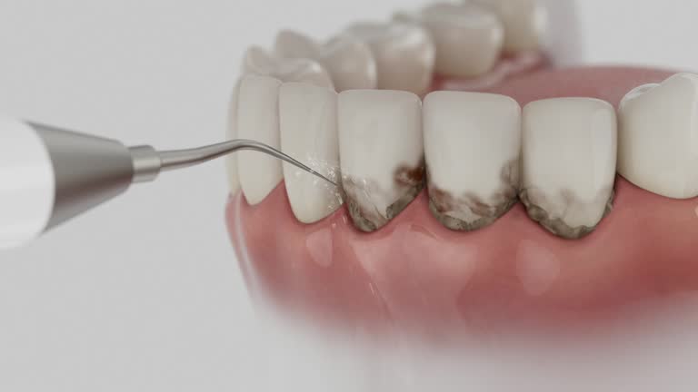 Reliable Dental contractor in Springfield, IL by Smile Center Dentistry
